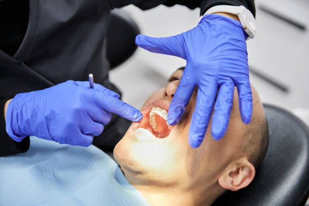Best Emergency Tooth Extraction in Milton, WA